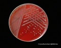 corynebacterium diphtheriae